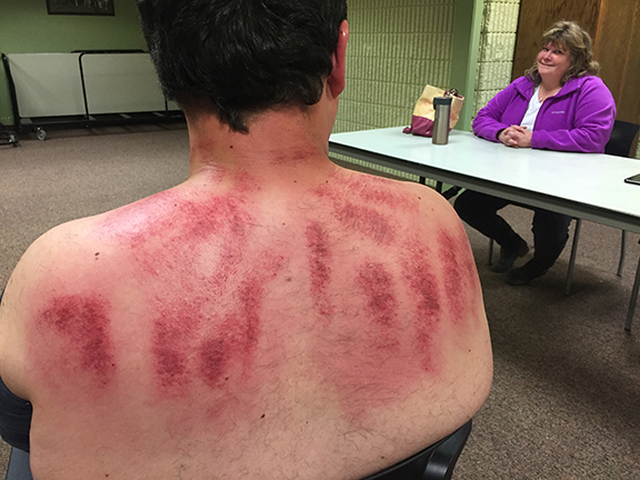 #1 Gua Sha Scraping Therapy in Montana Get Started pic